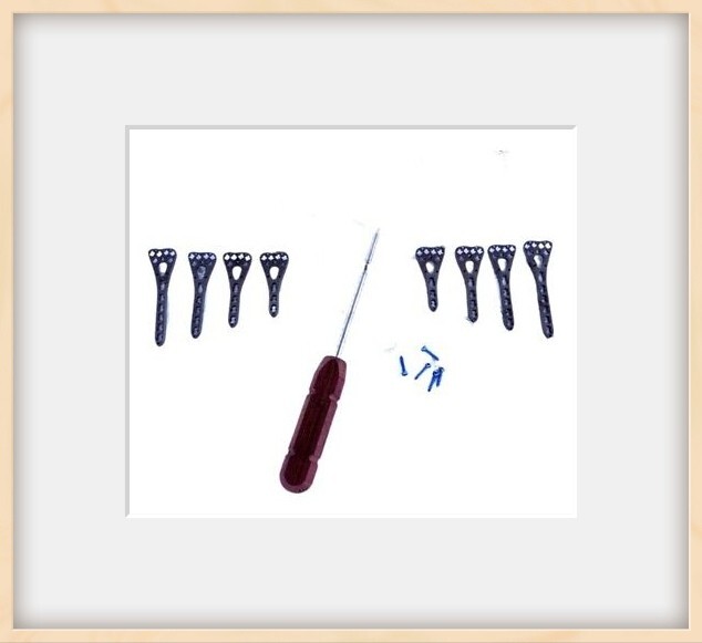 Distal Radius Volar Variable Angle LCP 2.7mm Plate 3 to 6 Holes RL Total 5 Pcs k