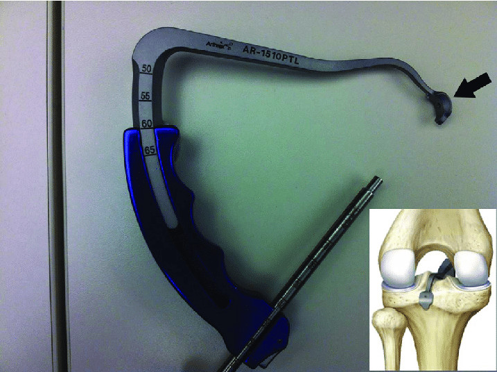 Arthrex ACL PCL C-type Drill Guide Knee Ligament Shoulder Femoral Tibia Guide