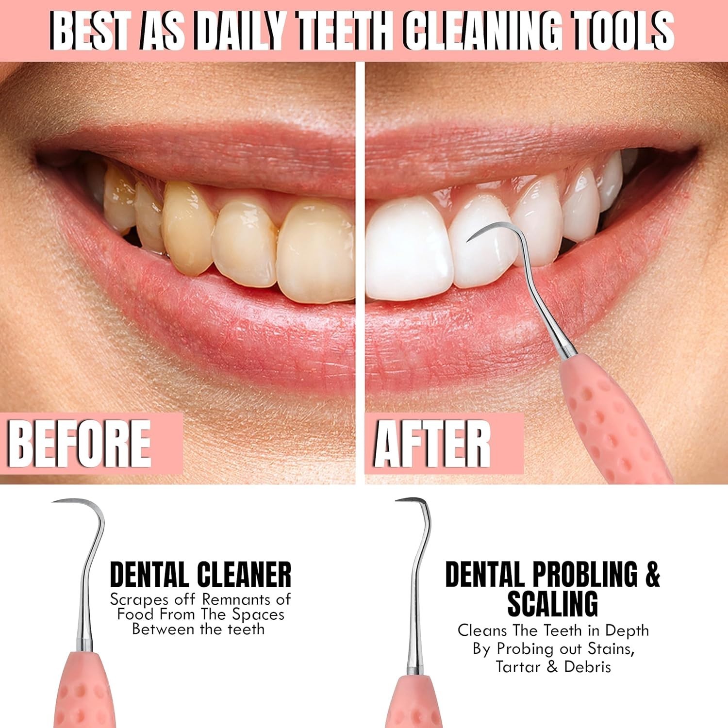Professional Dental Tools Tartar Scraper for Dentist, Personal Use and Pets Plaq