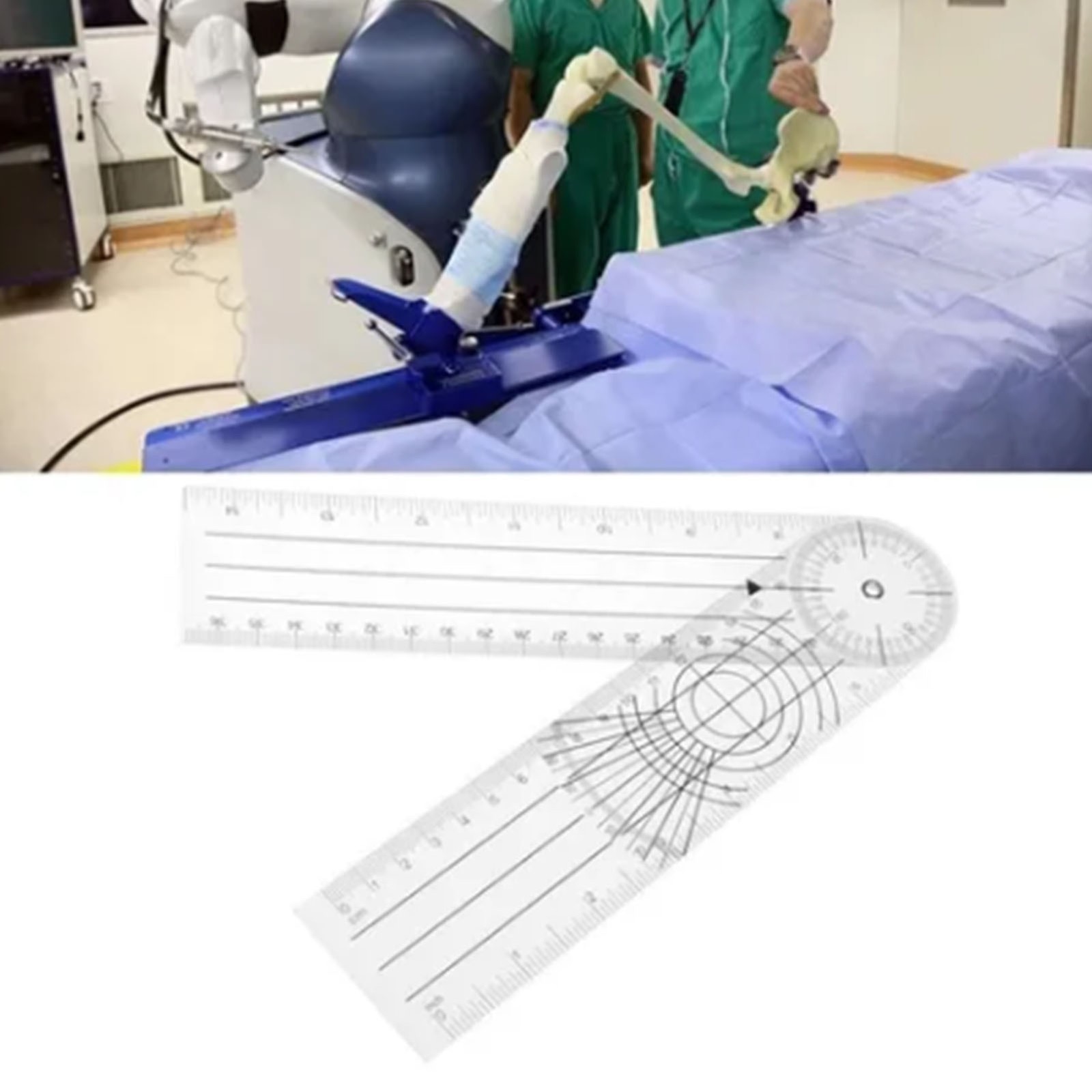 Orthopedic Ruler Goniometer Angle Ruler Human Bone Joint Measuring