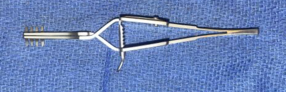 MERIT 97-378 Holzheimer Retractor (sharp tips)