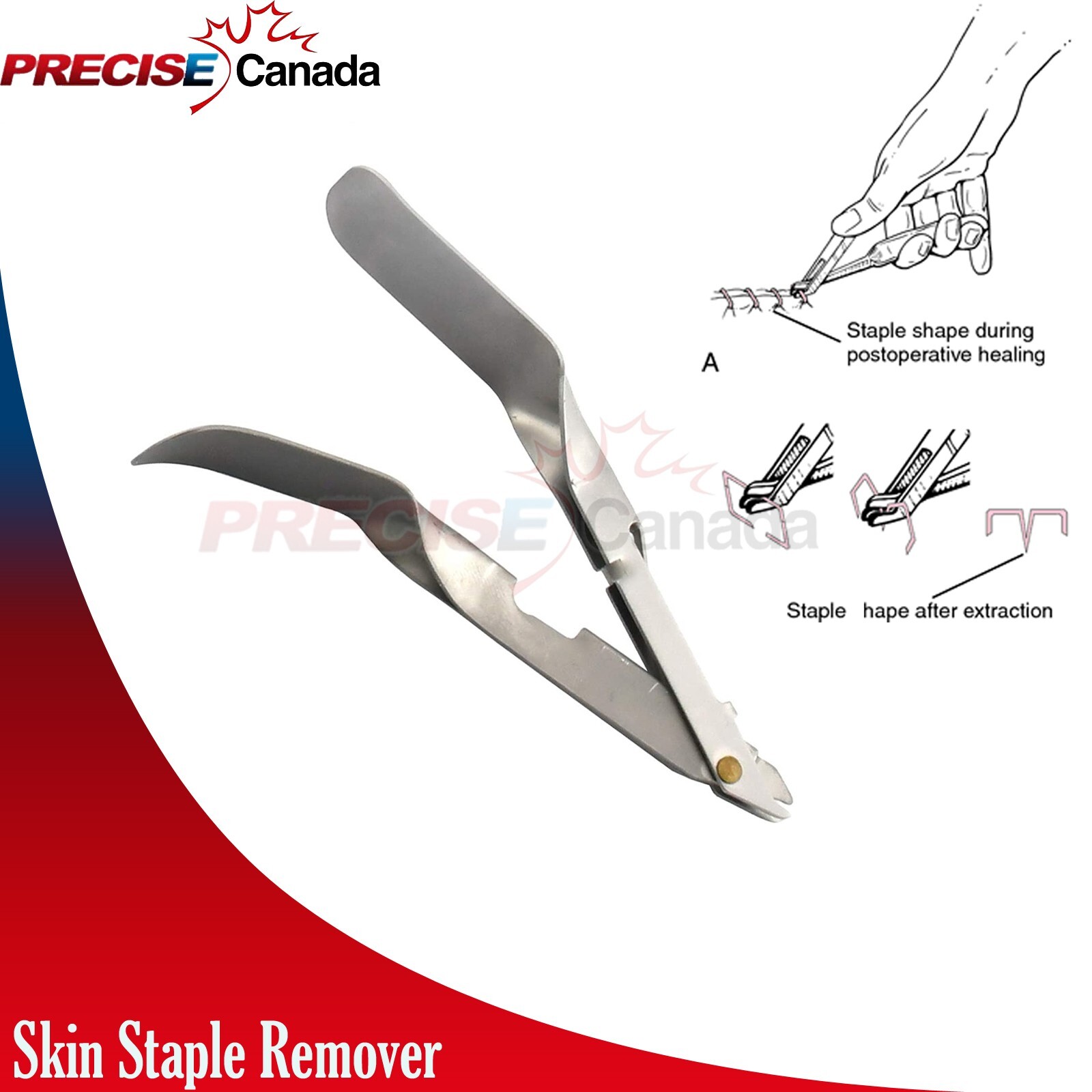 3 Pcs Surgical Disposable Skin Staple Remover Tweezer Style