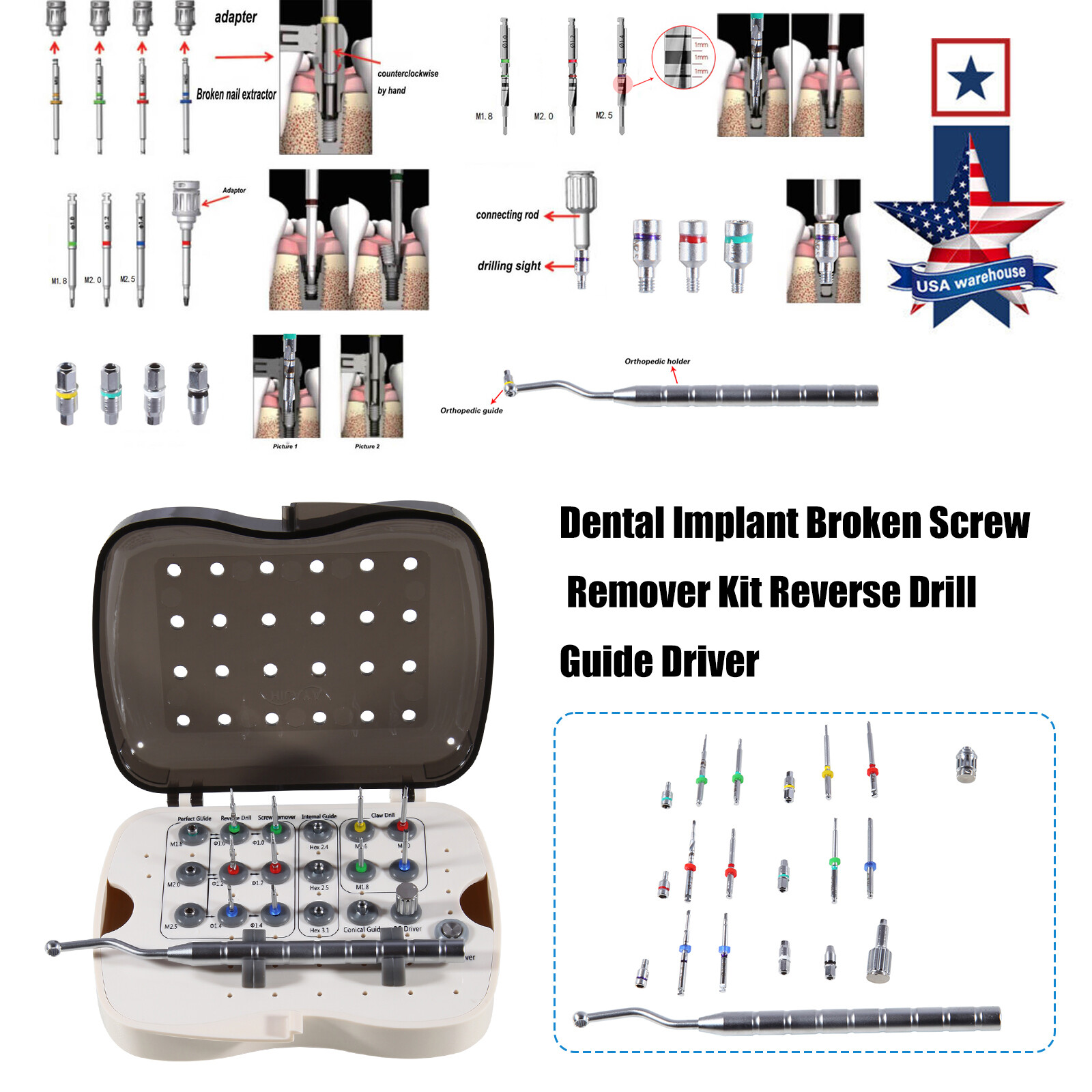 Implant Broken Screw Removal Screw Remover Rescue Tool Universal NeoBiotech Kit