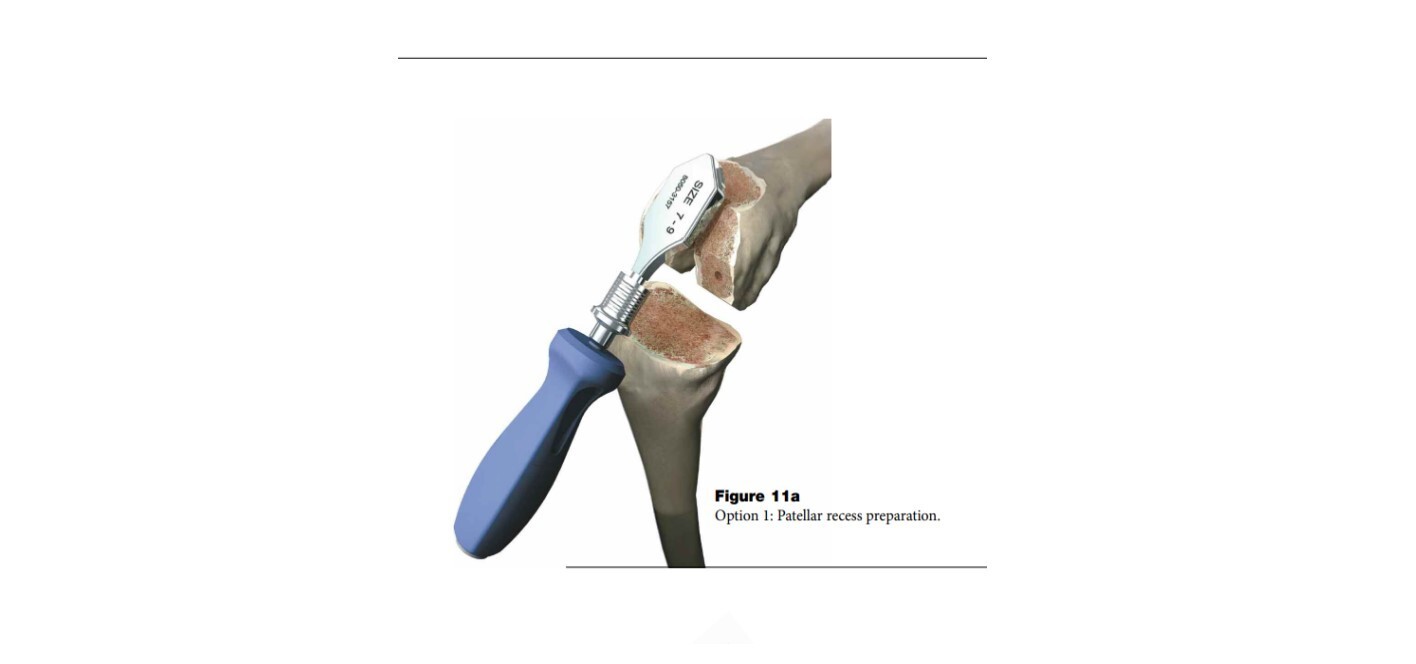 Stryker Osteonics Scorpio Patella Recess Rasp Set Sz 3-13 w Quick Connect Handle