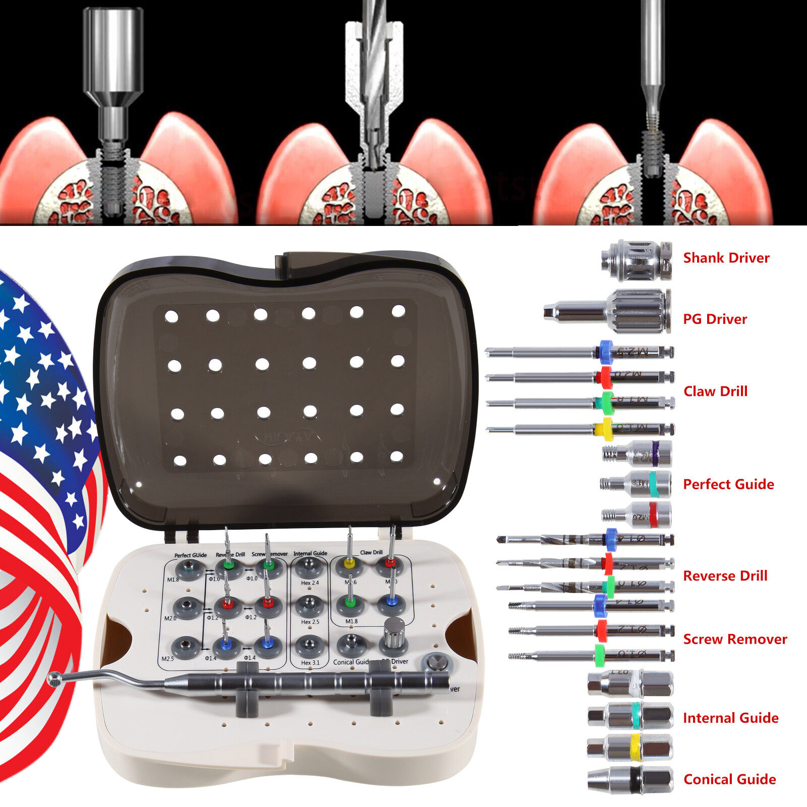 Implant Broken Screw Removal Screw Remover Rescue Tool Universal NeoBiotech Kit