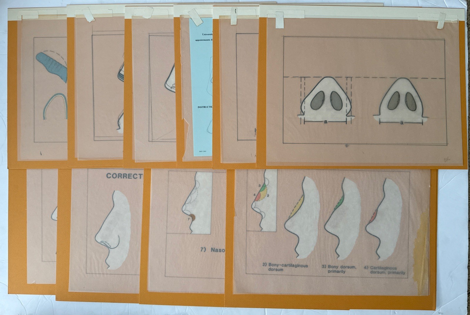 Vintage Nasal Plastic surgery Informational Image Cards Set Of 11