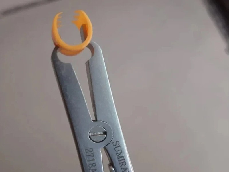 Raney Clips Disposable Clip Scalp Plastic Ranet 25 Nos