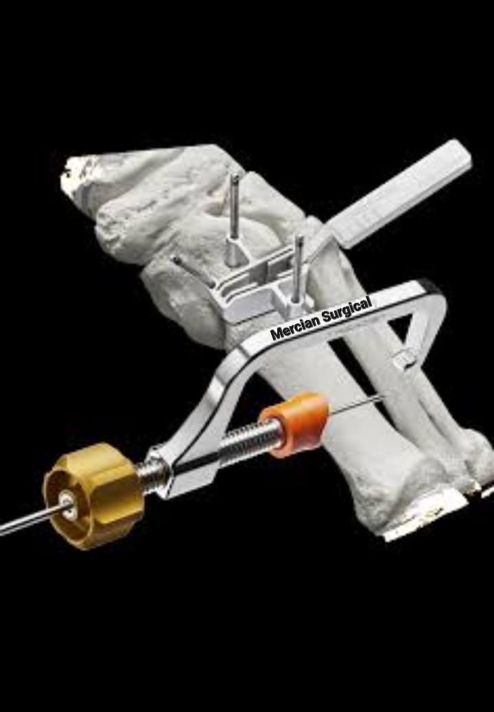 Micro Lapiplasty System Bunion Correction Minimally Invasive Stainless Offer