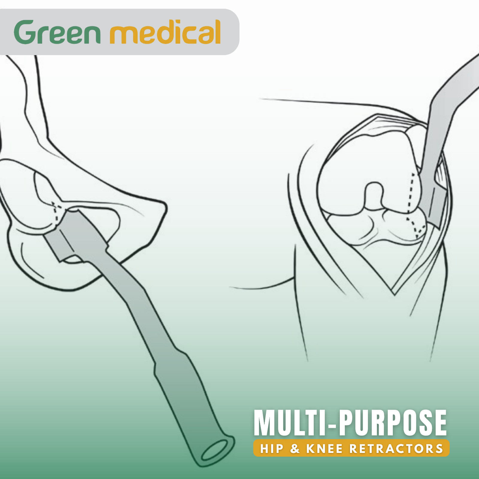 Surgical Retractors for Hip & Knee – Multi-Purpose Orthopedic Instruments