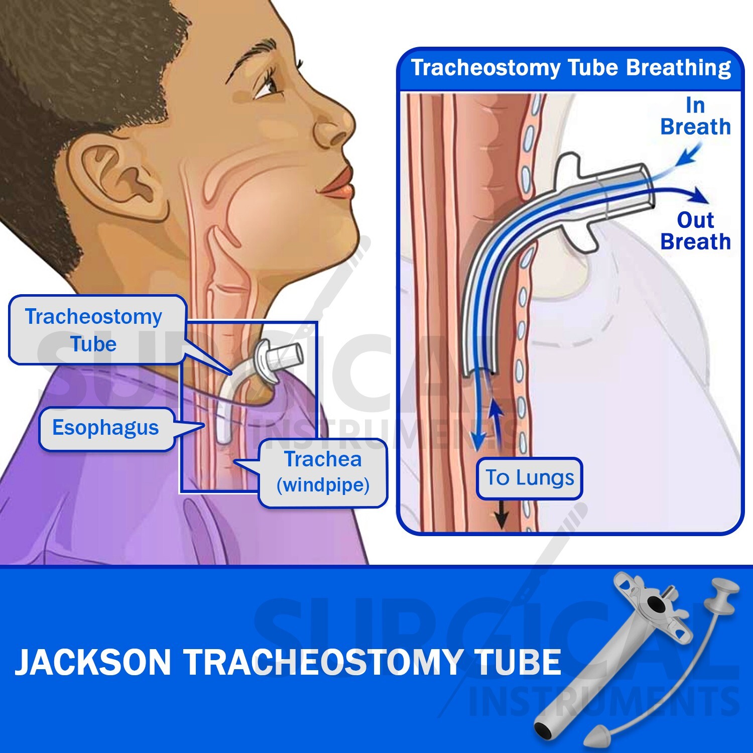 Jackson Trachea Tube Set Surgical Instrument Size 9 Stainless Steel German Grade