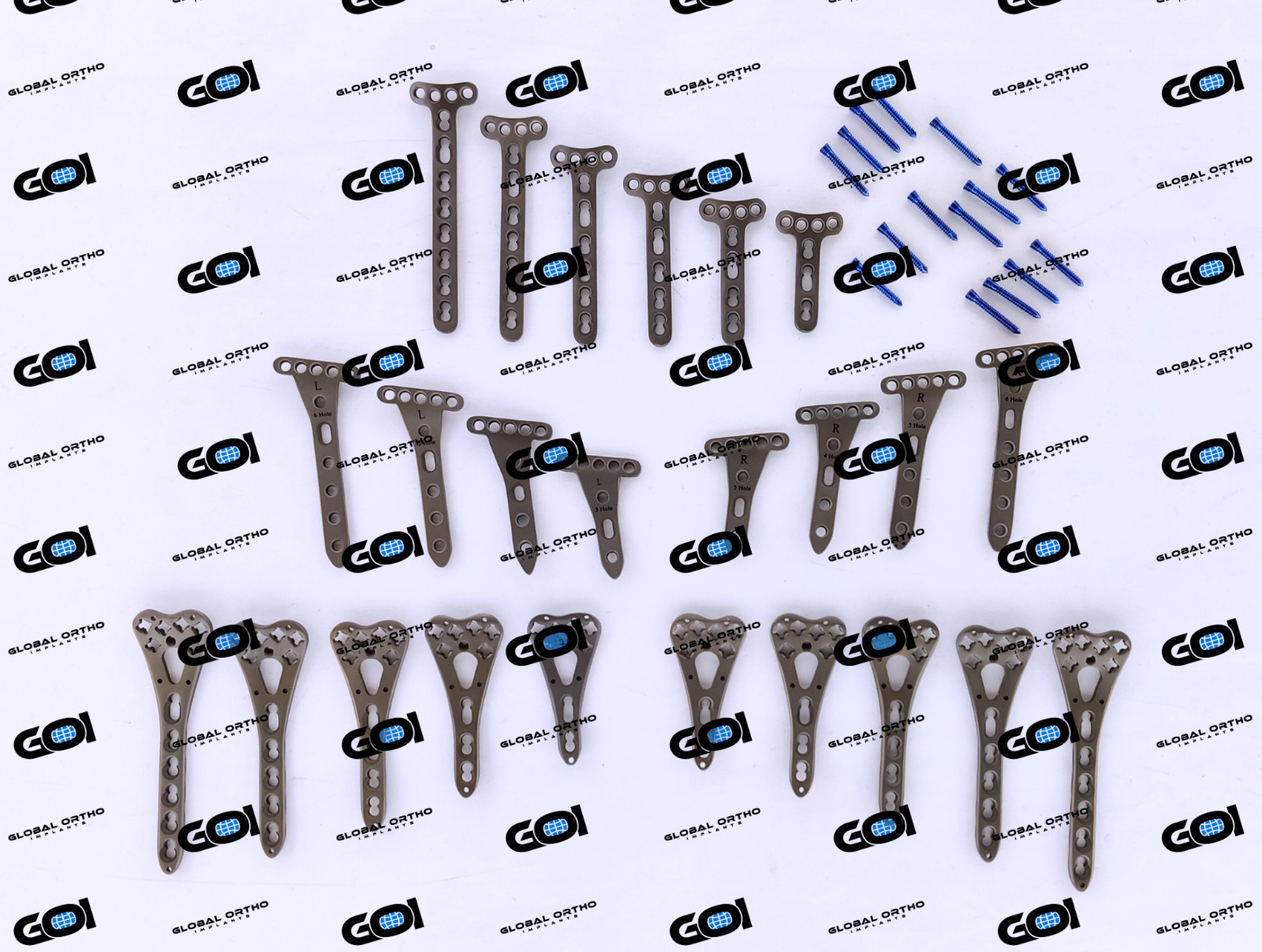 Titanium Locking Plates Set Volar, Extra, Juxta w/ 2.7mm Hex Fasteners 224 Pcs