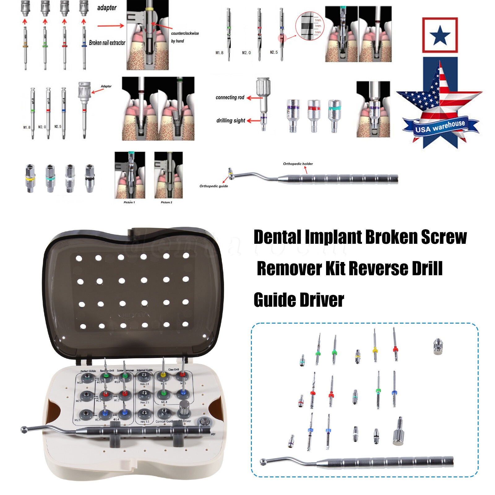 Universal Implant Fractured Broken Screw Removal Kit Surgical Remover NeoBiotech