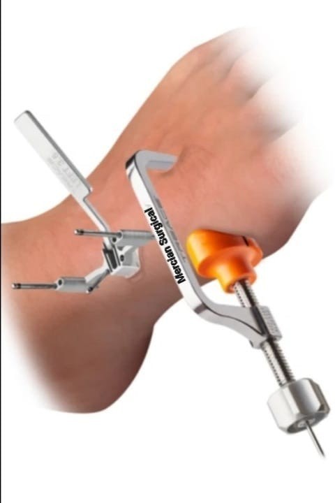 Micro Lapiplasty System Bunion Correction Minimally Invasive Stainless Offer
